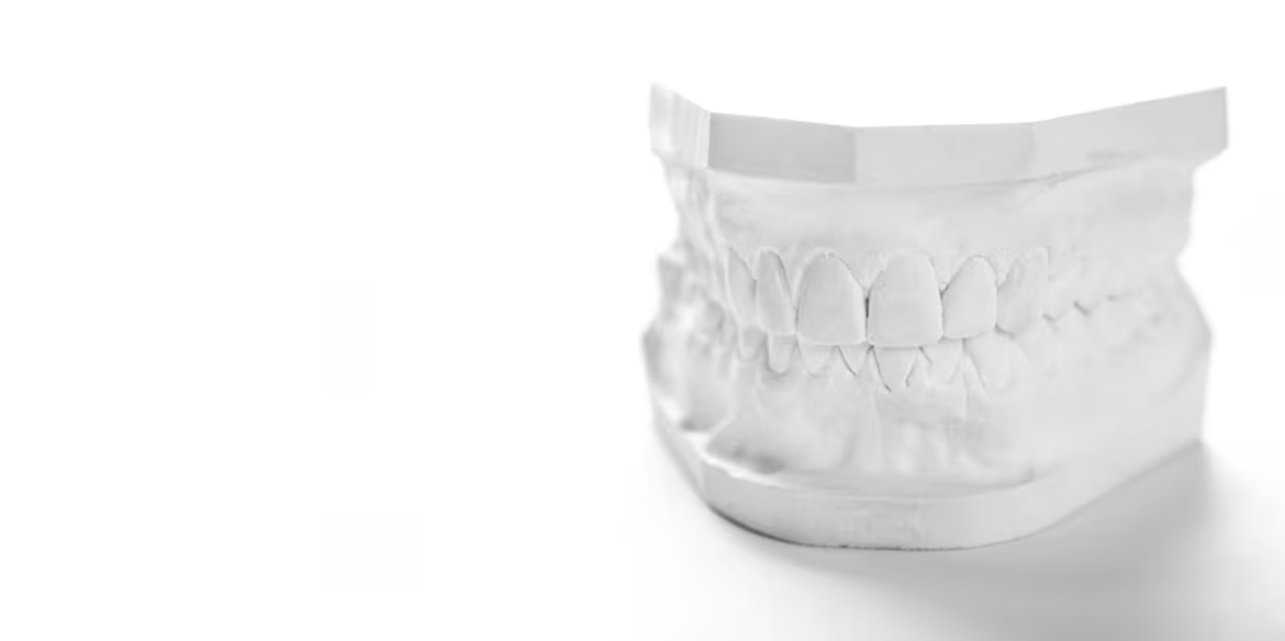 Глубокий прикус – современные способы лечения и профилактики