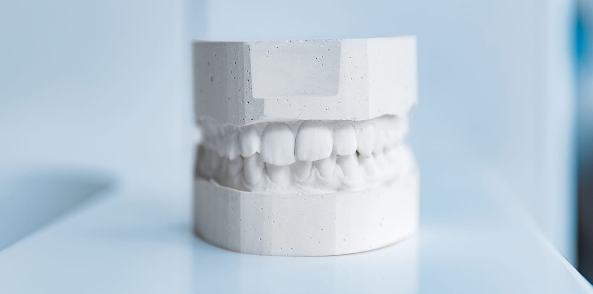 Когда верхняя челюсть «убегает» вперед. Дистальный прикус