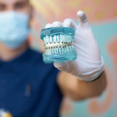 Брекет-системы