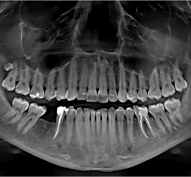 Ортопантомограмма